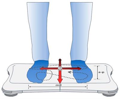 Effect of altitude and acetazolamide on postural control in healthy lowlanders 40 years of age or older. Randomized, placebo-controlled trial